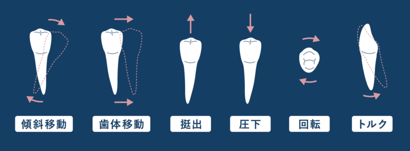 歯の動きの種類
