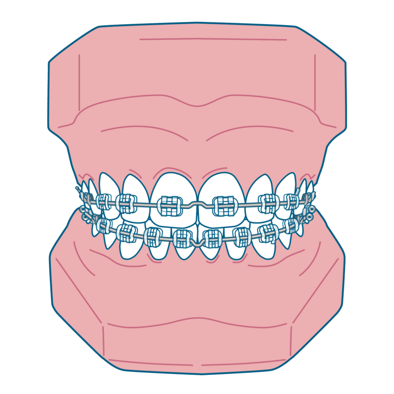 マルチブラケット装置