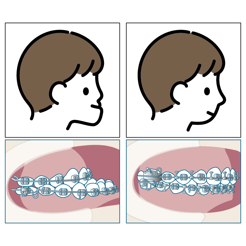 外科的矯正治療
