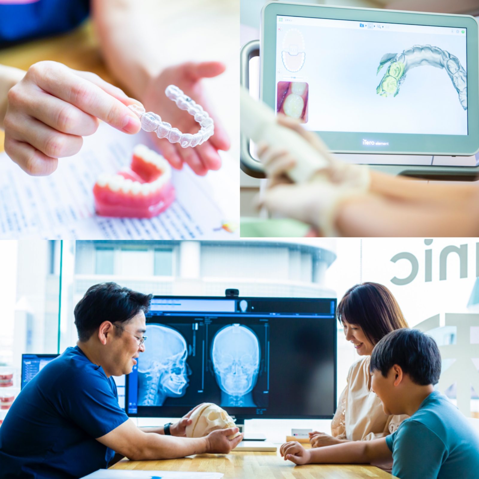 インビザライン