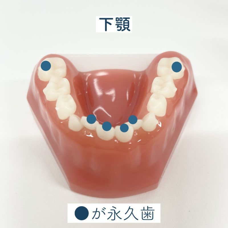 下顎・混合歯列