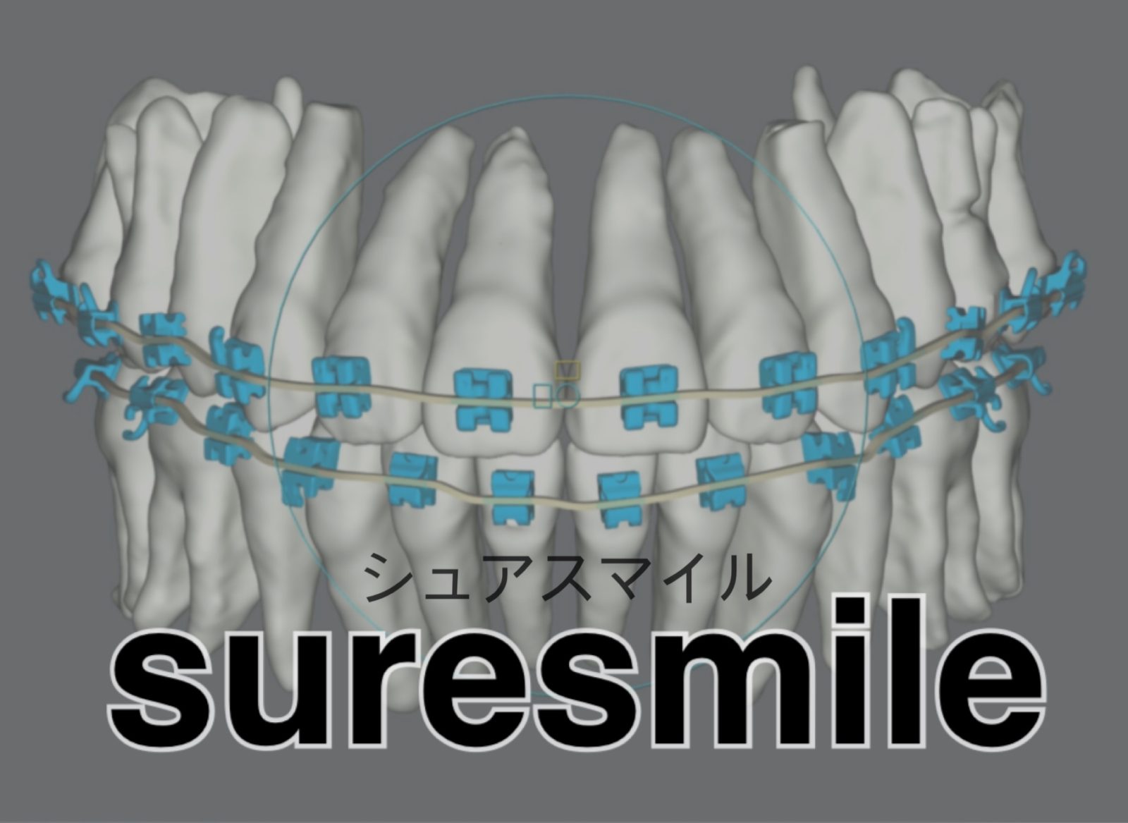 シュアスマイル