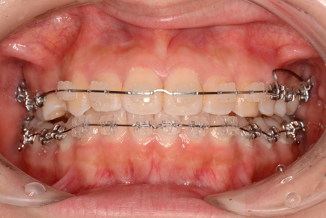 マルチブラケット装置