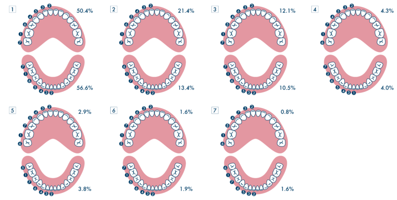 永久歯への生え変わり