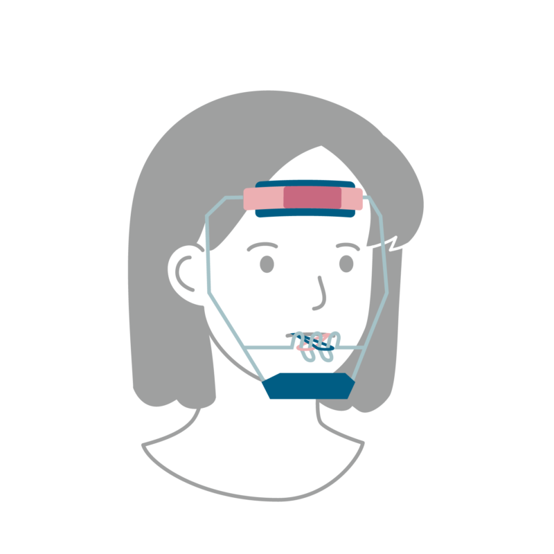 上顎前方牽引装置