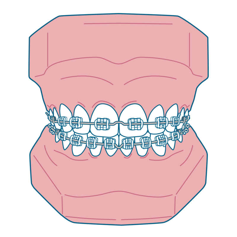 マルチブラケット装置