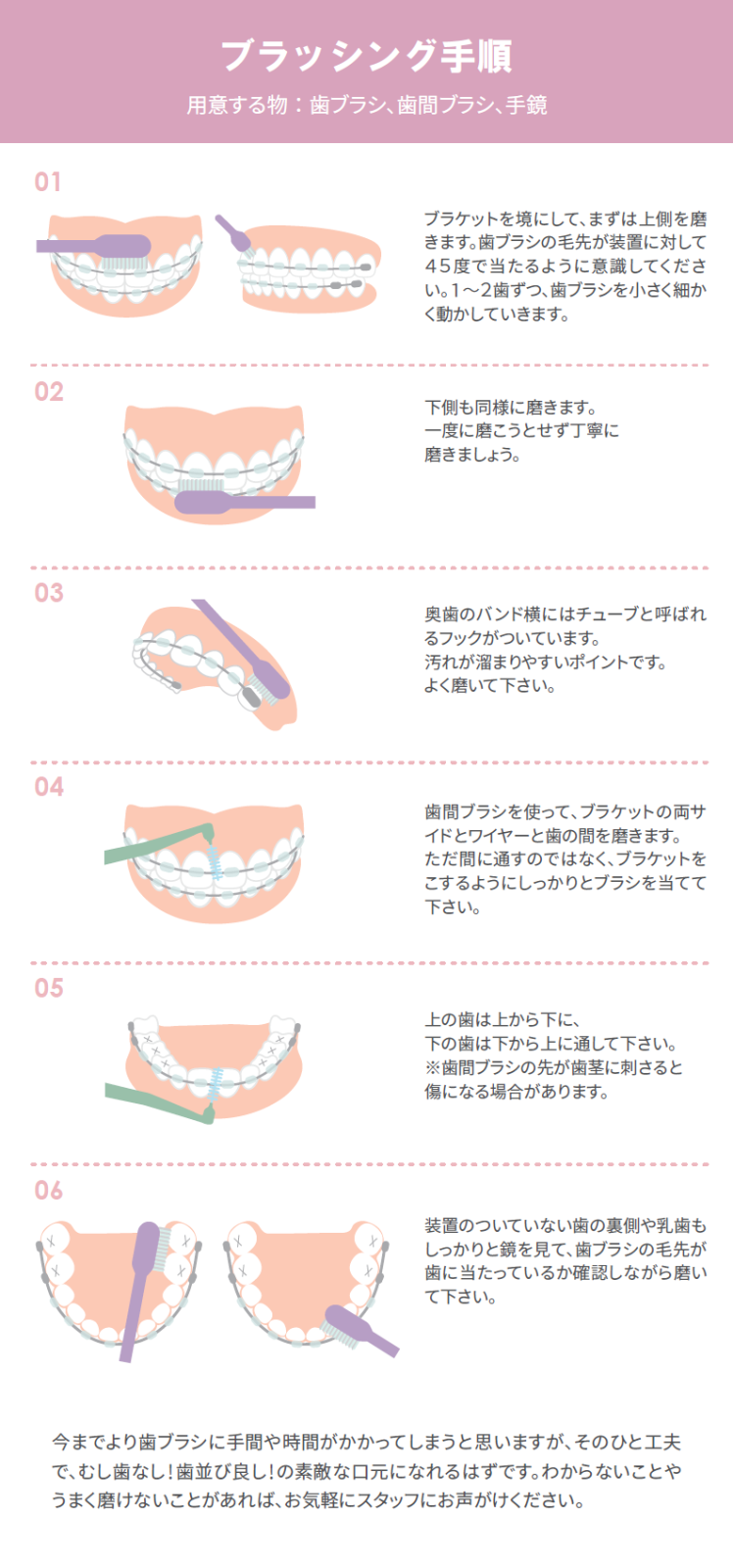 矯正治療 歯磨き