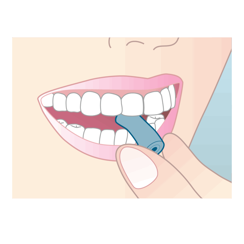 アライナーチューイ